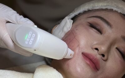 HIFU dan LIFU-Z di Surabaya: Teknologi Face Lifting Tanpa Operasi yang Wajib Kamu Tahu